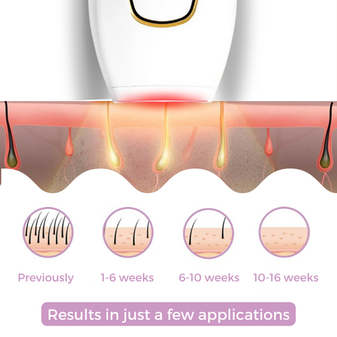 Lumeva™ IPL Laser Hair Remover